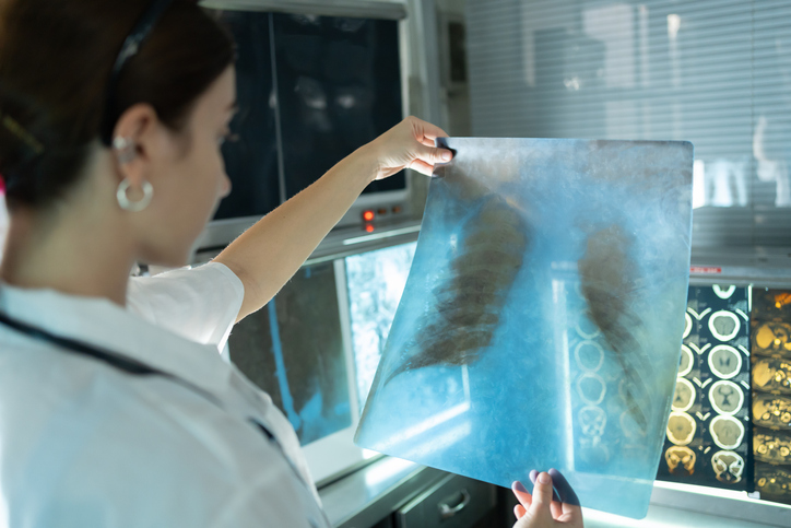 researcher looking at a scan